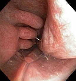 nose 4 nose 4